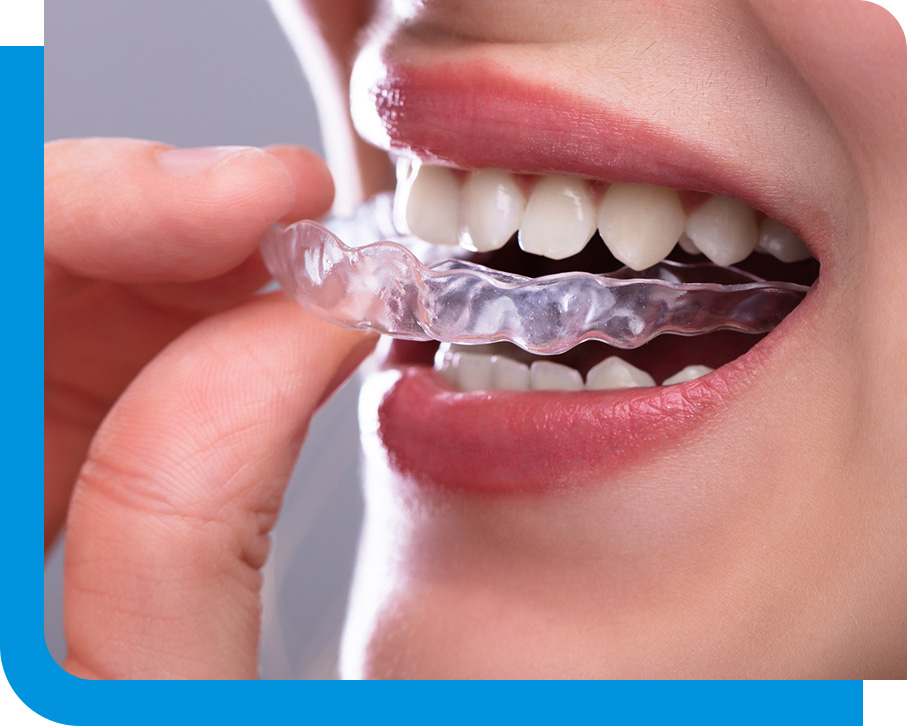 Night Guards in Atlanta, GA