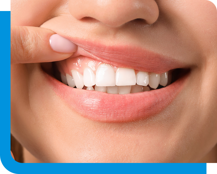 Periodontal Disease Treatment in Atlanta, GA