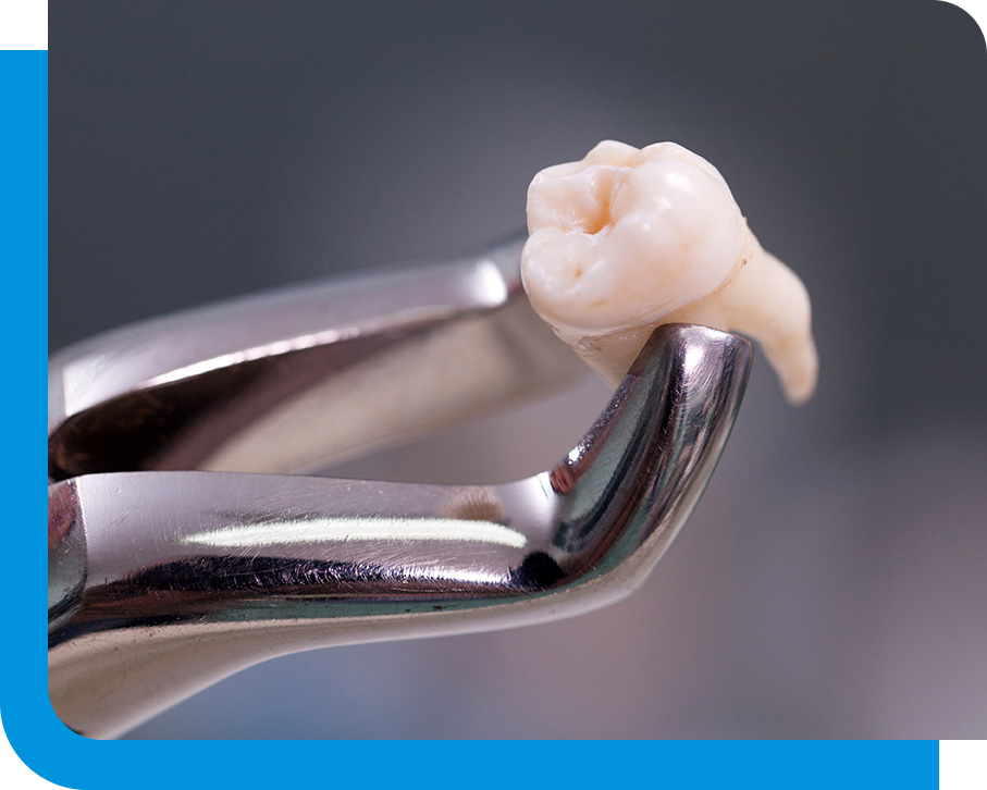 Quality Periodontal Splinting in Atlanta, GA