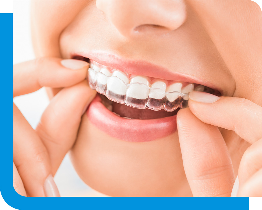 Invisalign in Atlanta, GA