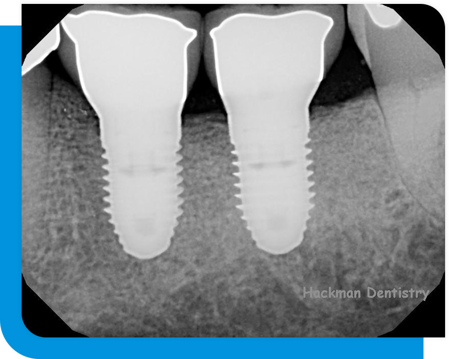 Reliable Digital X-Ray in Atlanta, GA