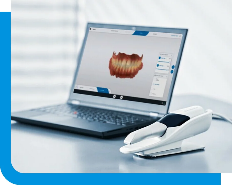 Intraoral scanner